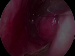 Sonde neurologiche ultra-piccole e flessibili usa e getta PLA407