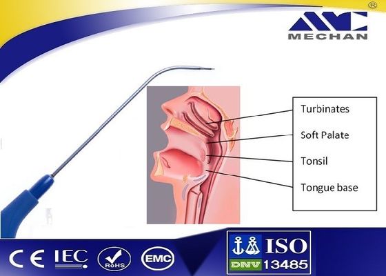 Sonda OTORINOLARINGOIATRICA del plasma di Mechan per la Manica e l'ablazione di Tubinate
